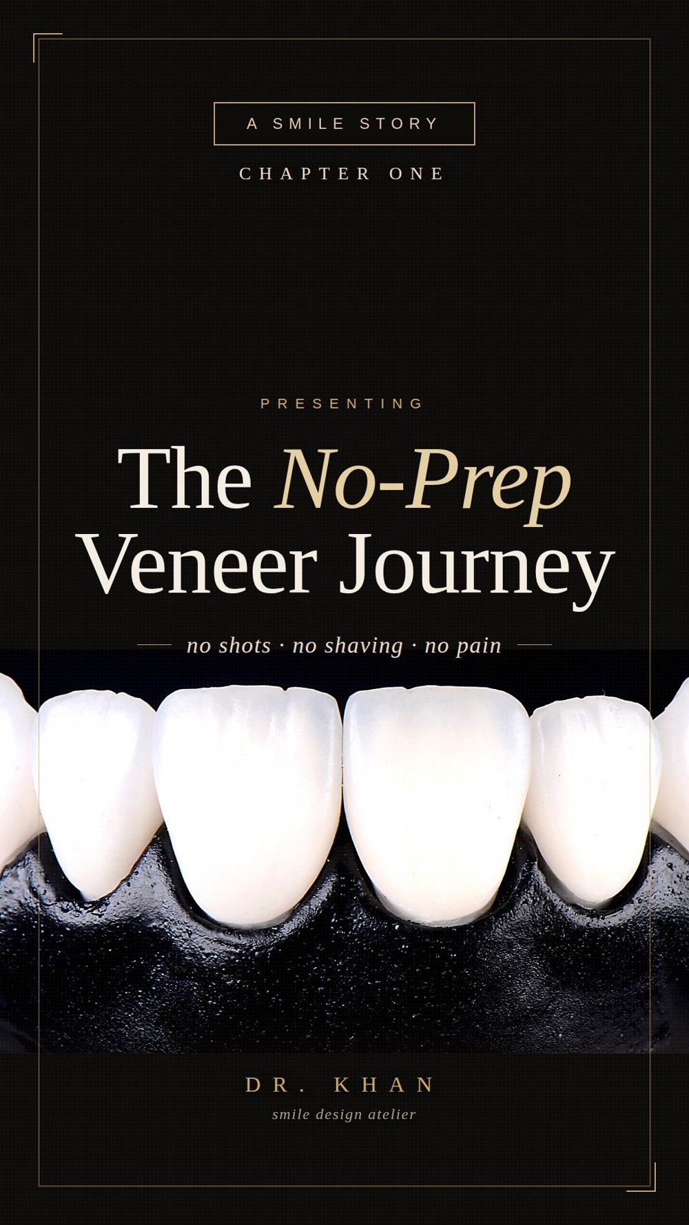The No-Prep Veneer Journey — no shots, no shaving, no pain