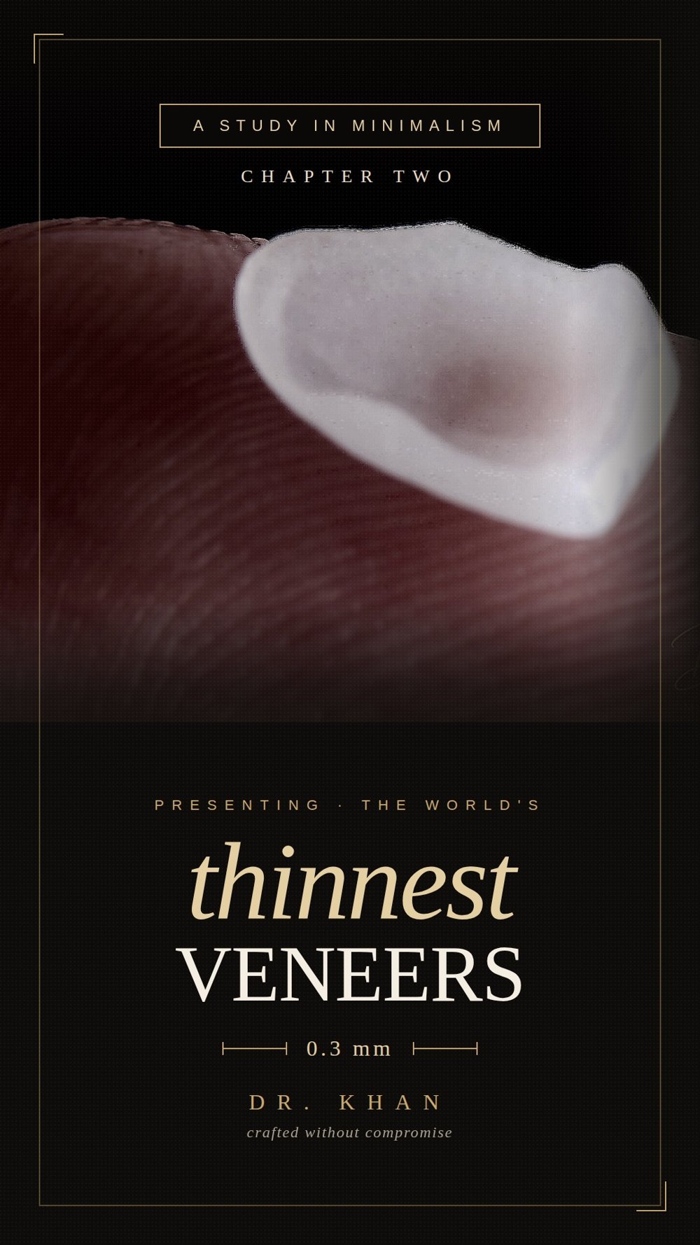 A study in minimalism — the world's thinnest veneers, 0.3 mm