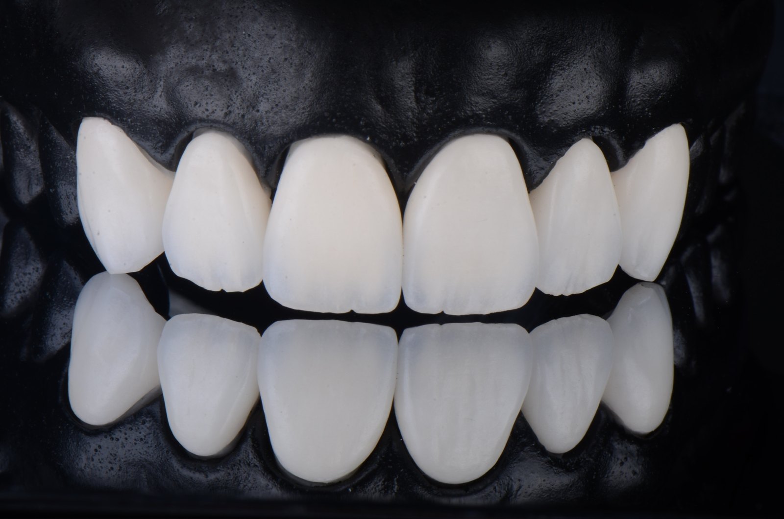 Hand-layered porcelain, photographed on a black model