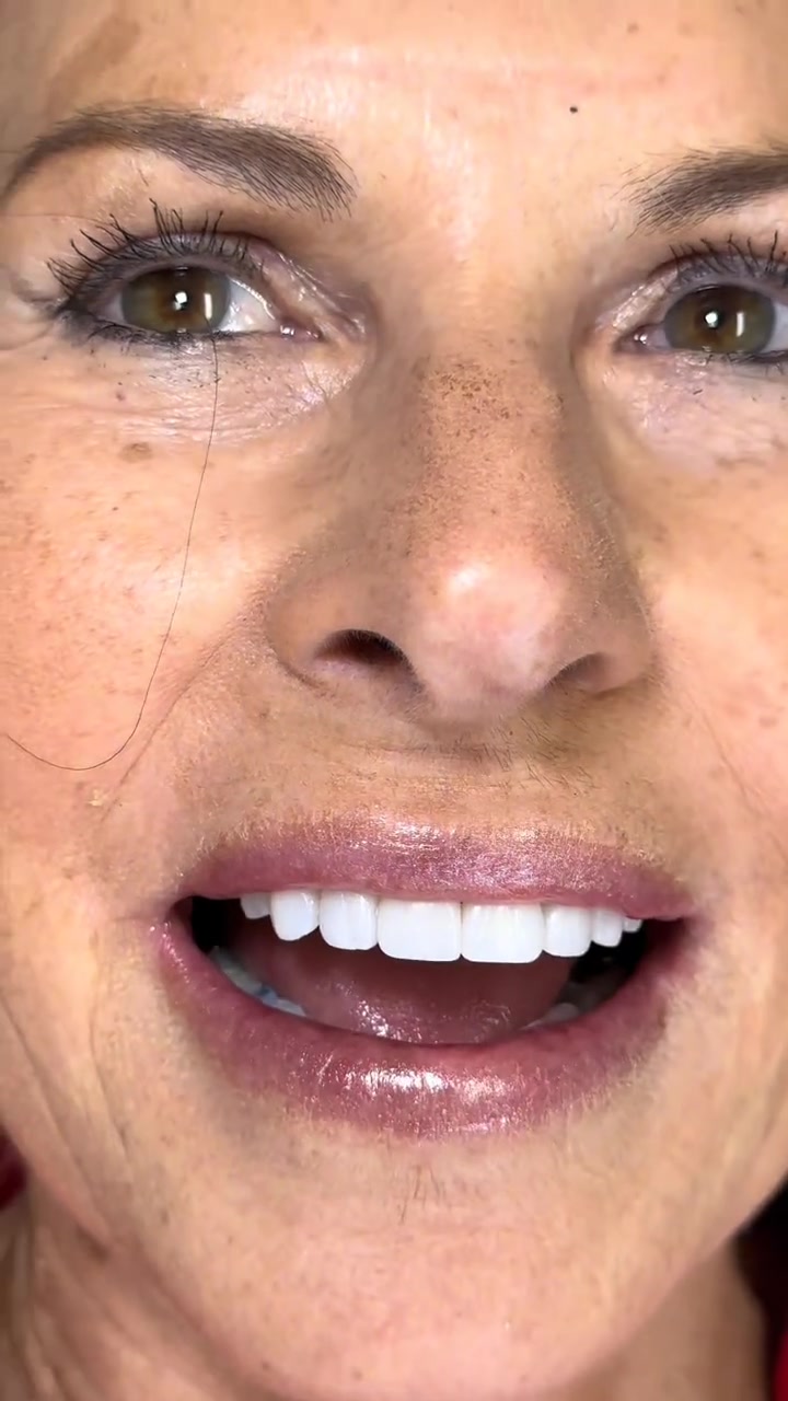 Smile after treatment by Dr. Khan