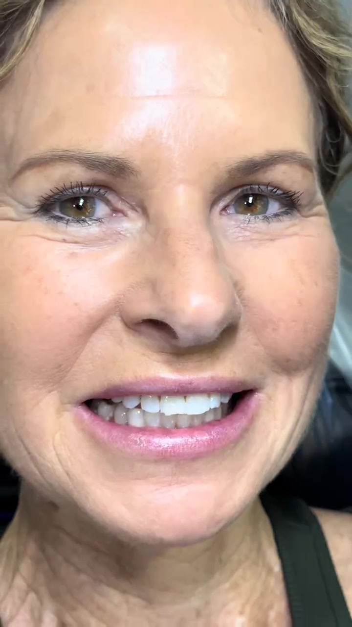 Smile before treatment