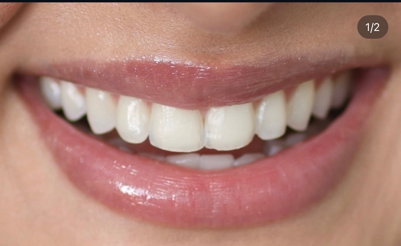 Smile before treatment